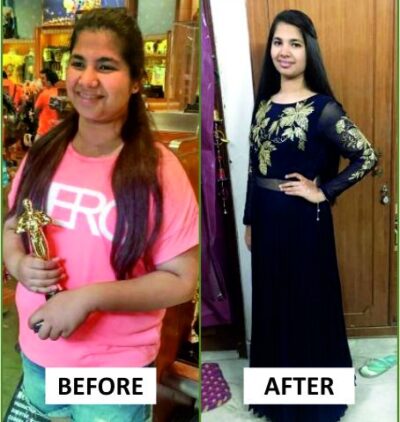 avani-before-after
